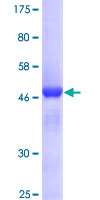 Recombinant Human Mre11 protein