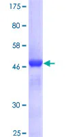 SDS-PAGE - Recombinant Human Mre11 protein (GST tag N-Terminus) (AB114277)