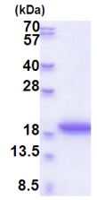 SDS-PAGE - Recombinant Human MRFAP1L1 protein (His tag N-Terminus) (AB177722)