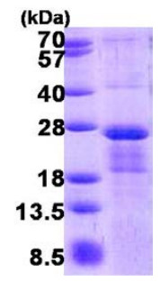 SDS-PAGE - Recombinant Human MRI protein (His tag N-Terminus) (AB140733)