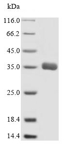 SDS-PAGE - Recombinant Human MRP1 protein (His tag) (AB235016), expandable thumbnail