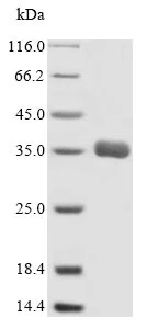 SDS-PAGE - Recombinant Human MRP1 protein (His tag) (AB235016)