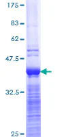 SDS-PAGE - Recombinant Human MRP2 protein (GST tag N-Terminus) (AB112272)