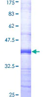 SDS-PAGE - Recombinant Human MRP4 protein (AB160907)