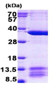 SDS-PAGE - Recombinant Human MRPL1 protein (His tag N-Terminus) (AB156342)