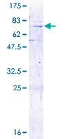 Recombinant Human MRPL3 protein