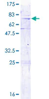 SDS-PAGE - Recombinant Human MRPL3 protein (AB153171)