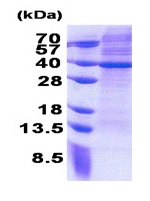 SDS-PAGE - Recombinant Human MRPS2 protein (His tag N-Terminus) (AB171597)