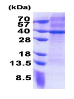 SDS-PAGE - Recombinant Human MRPS2 protein (His tag N-Terminus) (AB171597)
