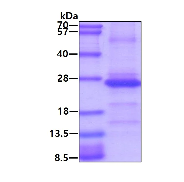 SDS-PAGE - Recombinant Human MRPS25 protein (denatured) (AB167854)
