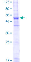 SDS-PAGE - Recombinant Human MS4A2 protein (GST tag N-Terminus) (AB158422)