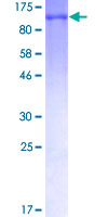 SDS-PAGE - Recombinant Human MSH2 protein (AB114351), expandable thumbnail