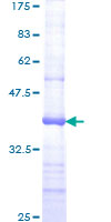 SDS-PAGE - Recombinant Human MSH6 protein (GST tag N-Terminus) (AB152443)