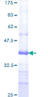 SDS-PAGE - Recombinant Human MSH6 protein (GST tag N-Terminus) (AB152443)
