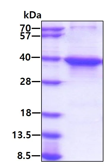 SDS-PAGE - Recombinant Human MSI2 protein (His tag N-Terminus) (AB167853)