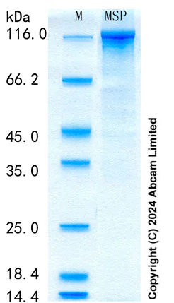 SDS-PAGE - Recombinant Human MSP Protein Standard (His tag) (AB316681)