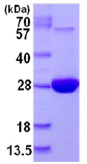 SDS-PAGE - Recombinant Human MSRA protein (His tag N-Terminus) (AB126699)