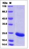 SDS-PAGE - Recombinant Human MSRB3 protein (His tag) (AB276641)