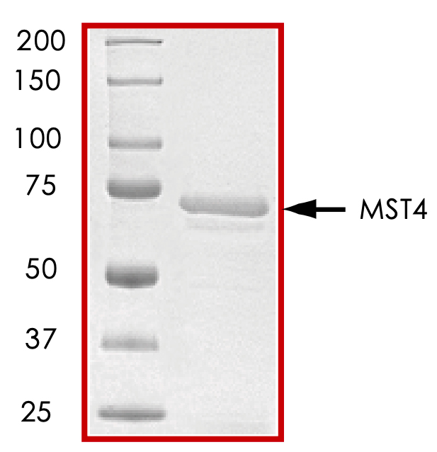 SDS-PAGE - Recombinant human MST4 protein (AB60341), expandable thumbnail