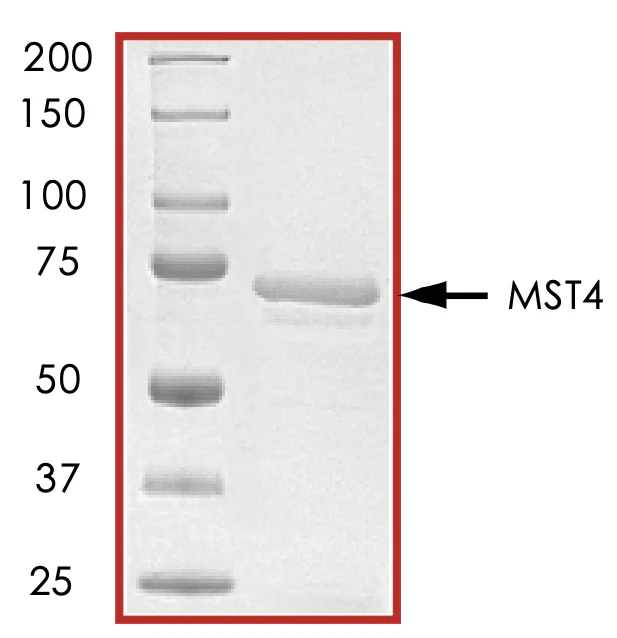SDS-PAGE - Recombinant human MST4 protein (AB60341)