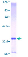 SDS-PAGE - Recombinant Human MT1E protein (GST tag N-Terminus) (AB158923)