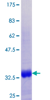 SDS-PAGE - Recombinant Human MT1G protein (GST tag N-Terminus) (AB158925)