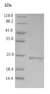 SDS-PAGE - Recombinant Human MT3 protein (Tagged) (AB235794)