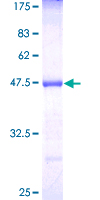 SDS-PAGE - Recombinant Human MTAP protein (GST tag N-Terminus) (AB132581)