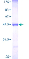 SDS-PAGE - Recombinant Human MTAP protein (GST tag N-Terminus) (AB132581)