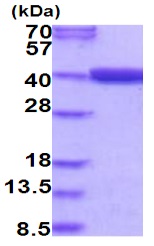SDS-PAGE - Recombinant Human MTHFD2 protein (AB202178), expandable thumbnail