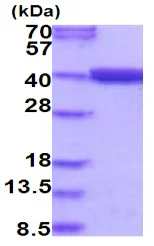 SDS-PAGE - Recombinant Human MTHFD2 protein (AB202178)