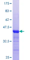 SDS-PAGE - Recombinant Human MTMR3 protein (GST tag N-Terminus) (AB160253)