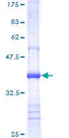SDS-PAGE - Recombinant Human mTOR protein (GST tag N-Terminus) (AB114179)