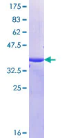 SDS-PAGE - Recombinant Human MUC16 protein (AB164957)