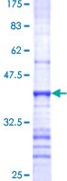 SDS-PAGE - Recombinant Human MUC4 protein (AB130768), expandable thumbnail