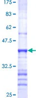 SDS-PAGE - Recombinant Human MUC4 protein (GST tag N-Terminus) (AB130768)