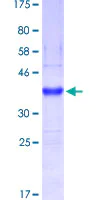 SDS-PAGE - Recombinant Human MUC5B protein (AB153651)