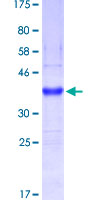SDS-PAGE - Recombinant Human MUC5B protein (GST tag N-Terminus) (AB153651)
