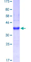 SDS-PAGE - Recombinant Human MUC5B protein (GST tag N-Terminus) (AB153651)
