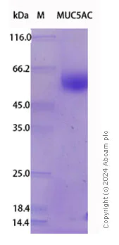 SDS-PAGE - Recombinant Human Mucin 5AC Protein Standard (His tag) (AB316446)