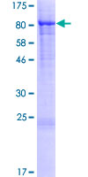 Recombinant Human Munc18c protein