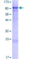SDS-PAGE - Recombinant Human Munc18c protein (GST tag N-Terminus) (AB159609)