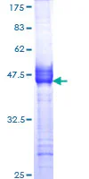 SDS-PAGE - Recombinant Human Muscarinic Acetylcholine Receptor 2/CM2 protein (GST tag N-Terminus) (AB152277)