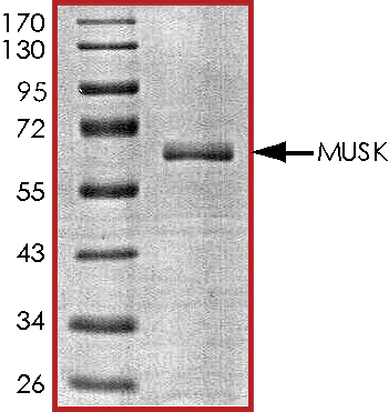 SDS-PAGE - Recombinant human MUSK protein (AB71693)