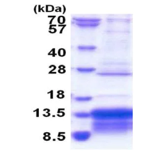 SDS-PAGE - Recombinant Human MUSTN1 protein (AB183251)