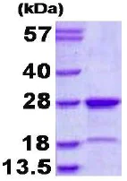 SDS-PAGE - Recombinant Human Muted protein (His tag N-Terminus) (AB130060)