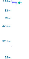 SDS-PAGE - Recombinant Human MVP protein (GST tag N-Terminus) (AB153030)