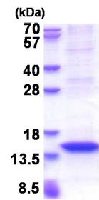 SDS-PAGE - Recombinant Human MX2 protein (denatured) (AB177616), expandable thumbnail