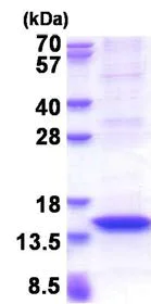 SDS-PAGE - Recombinant Human MX2 protein (denatured) (His tag N-Terminus) (AB177616)