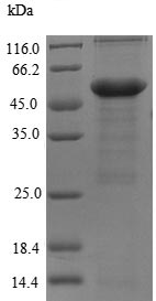 SDS-PAGE - Recombinant Human MYBPC3 protein (His tag) (AB225662), expandable thumbnail